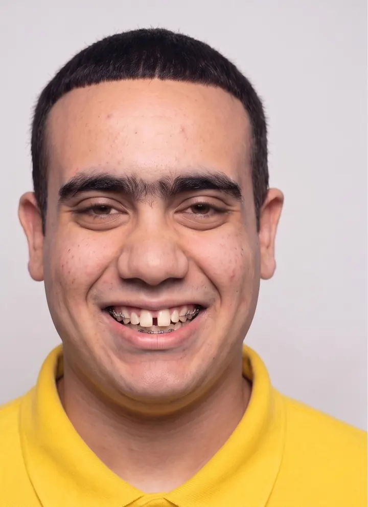 Pachi in his yellow polo